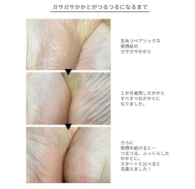 Hummingbird(ハミングバード)かかとつるつる生糸リペア五本指ソックス 620911 -4